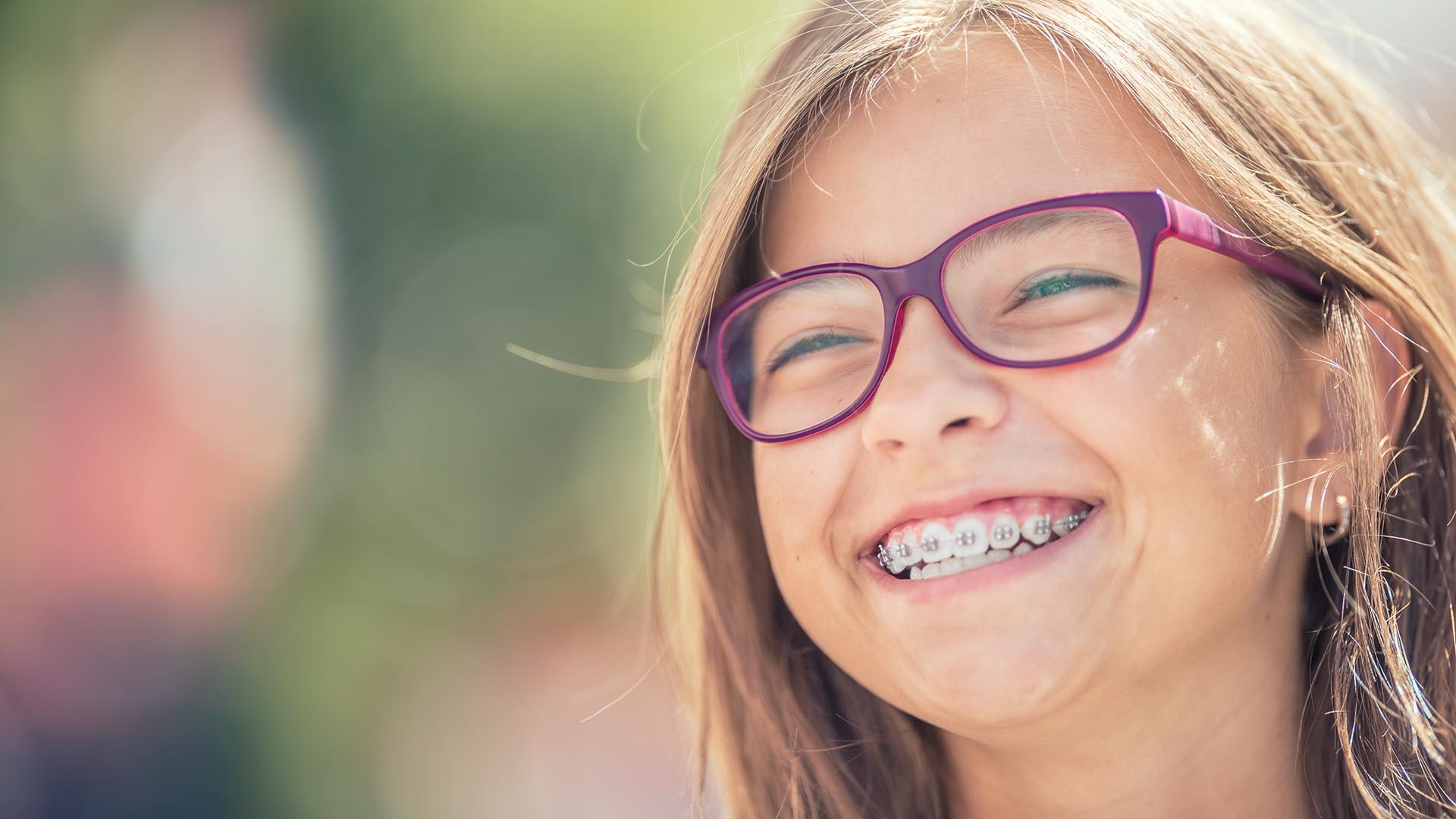 How Long Do Braces Take for Crowded Teeth