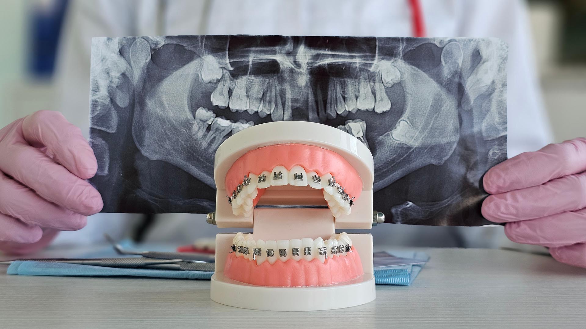 What Are Orthodontic Services?