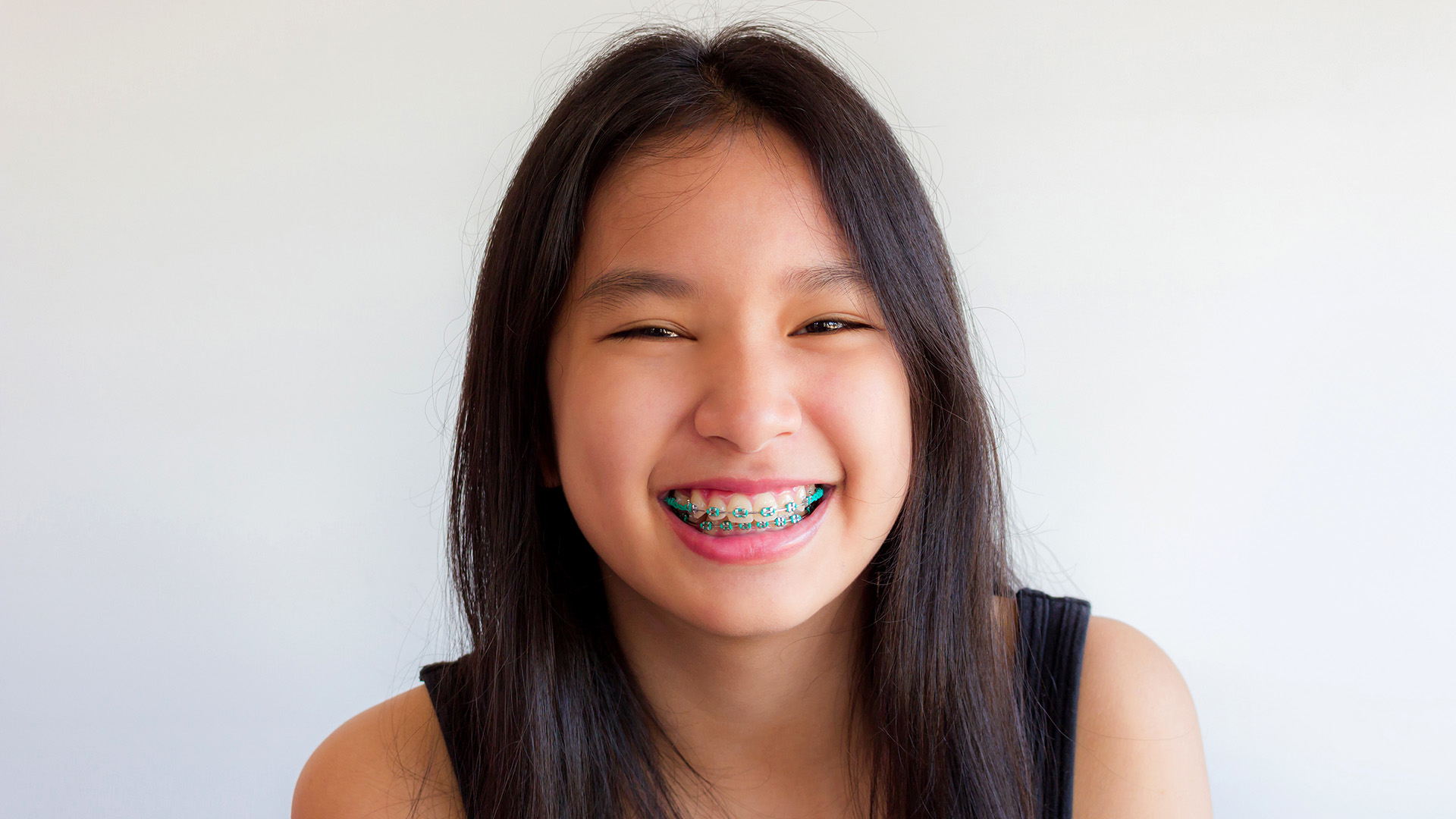 Why do I need braces, reasons for needing braces and are braces necessary?