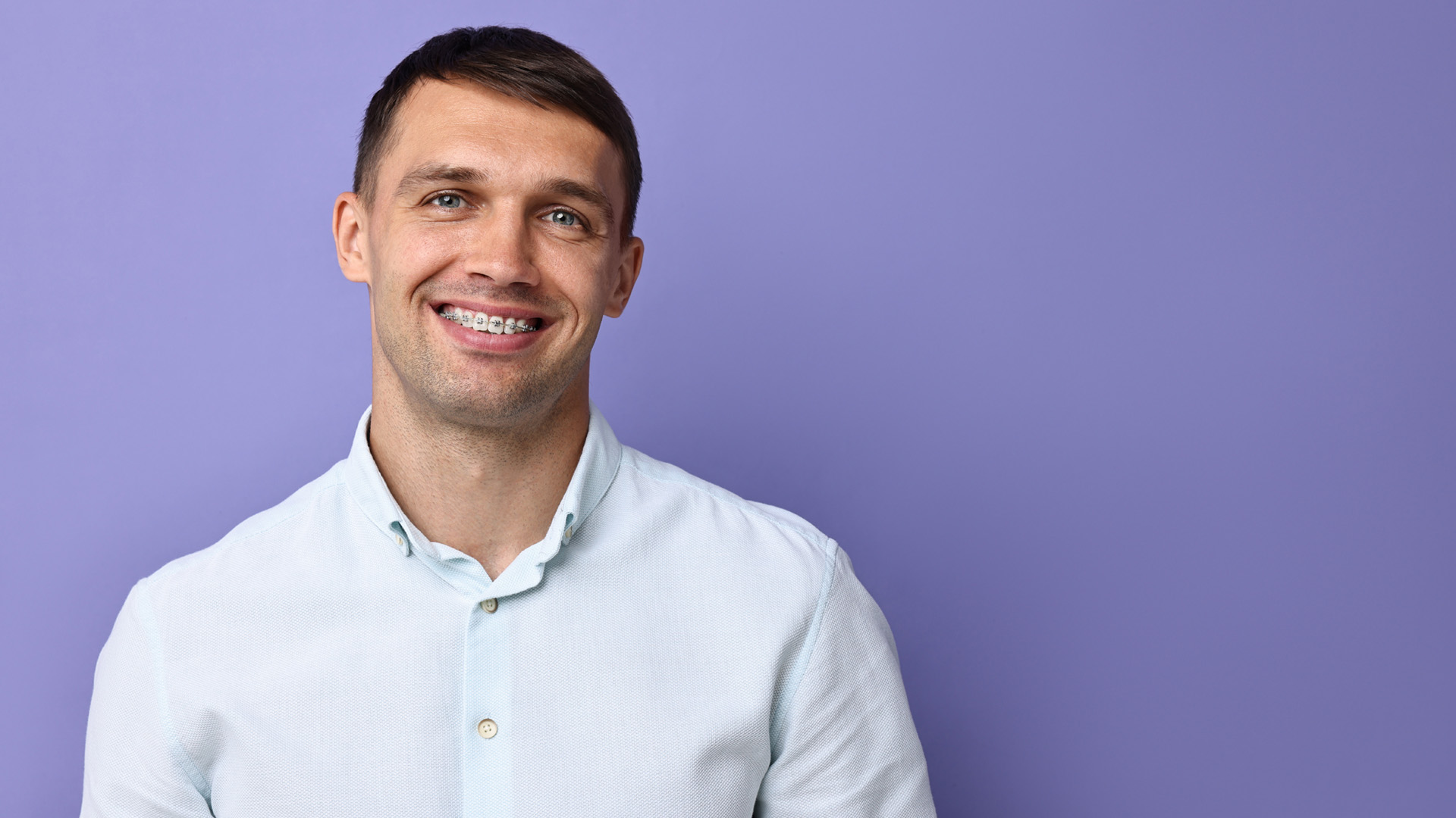How Much Do Braces Cost for Adults?