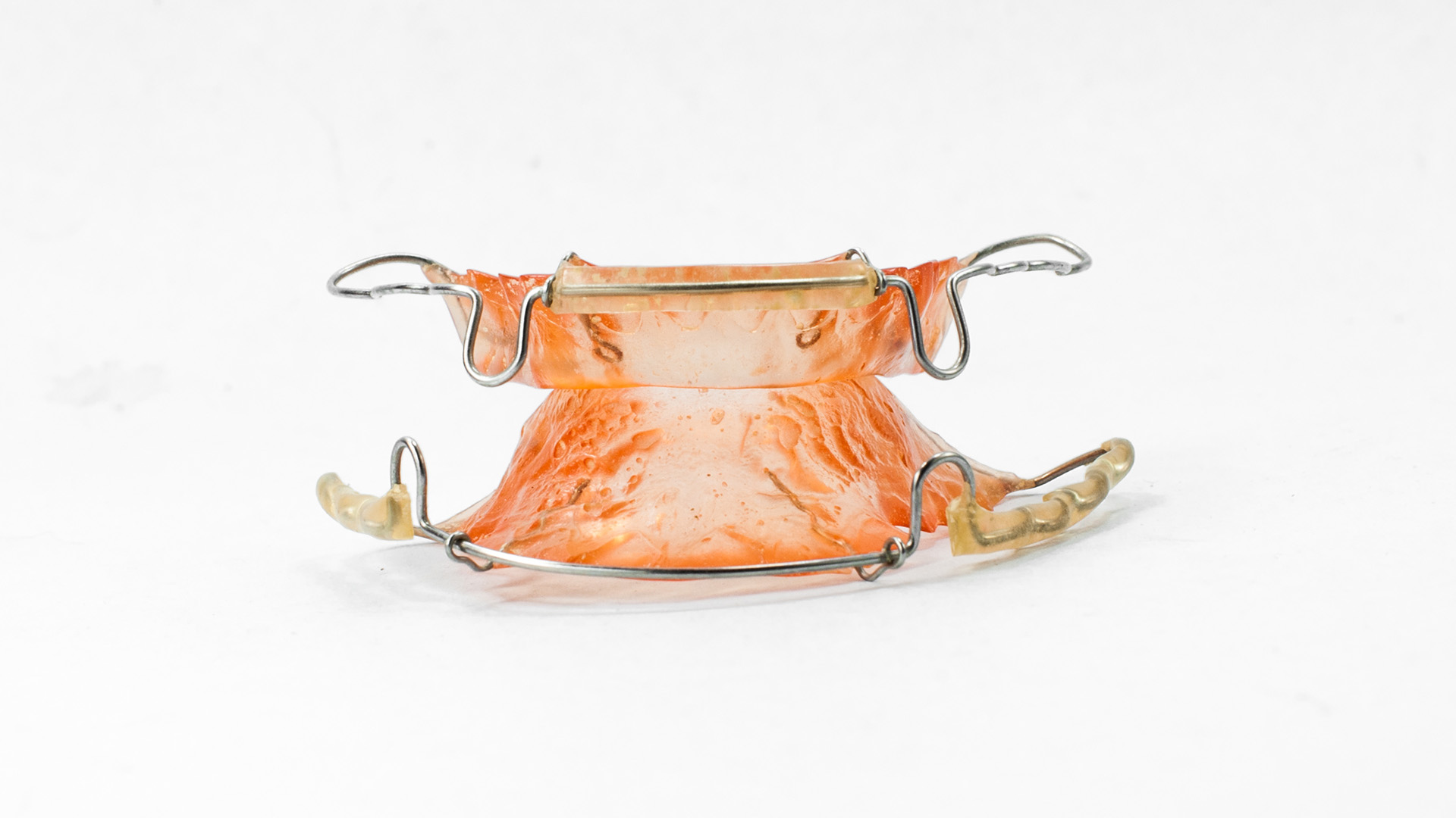 What Happens If You Don’t Wear Your Retainer?