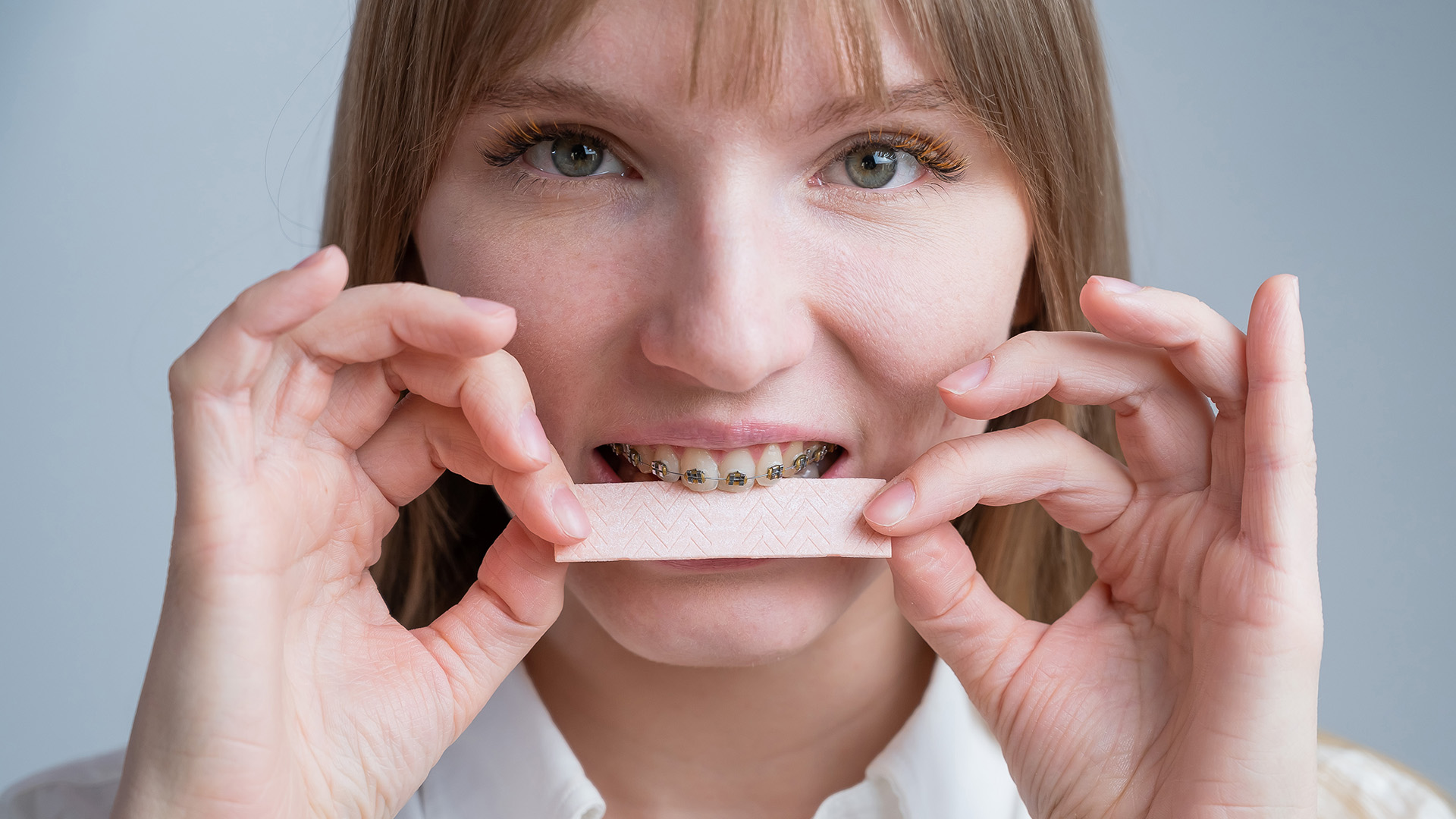 Can You Chew Gum with Braces?