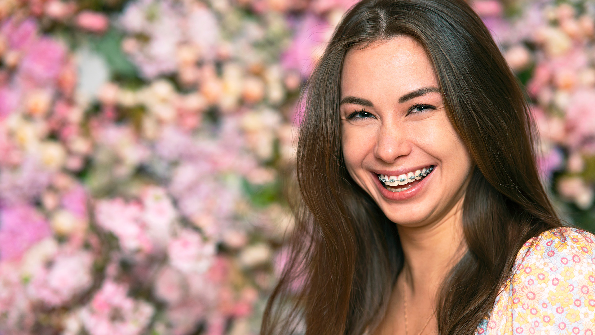 How Long Do Your Teeth Hurt After Getting Braces?