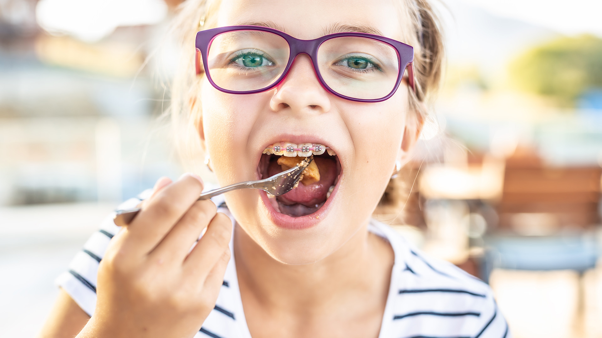 what to eat with braces the first week