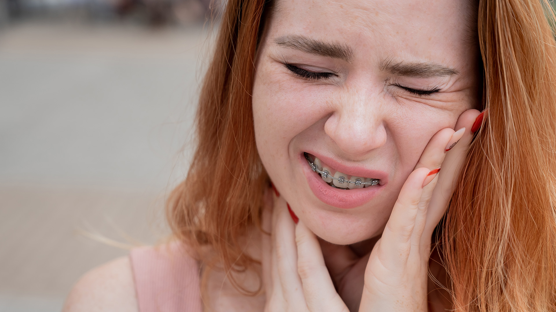 Orthodontic Emergencies