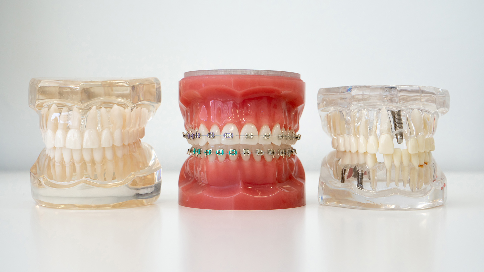 Orthodontic Relapse Risk by Case Type