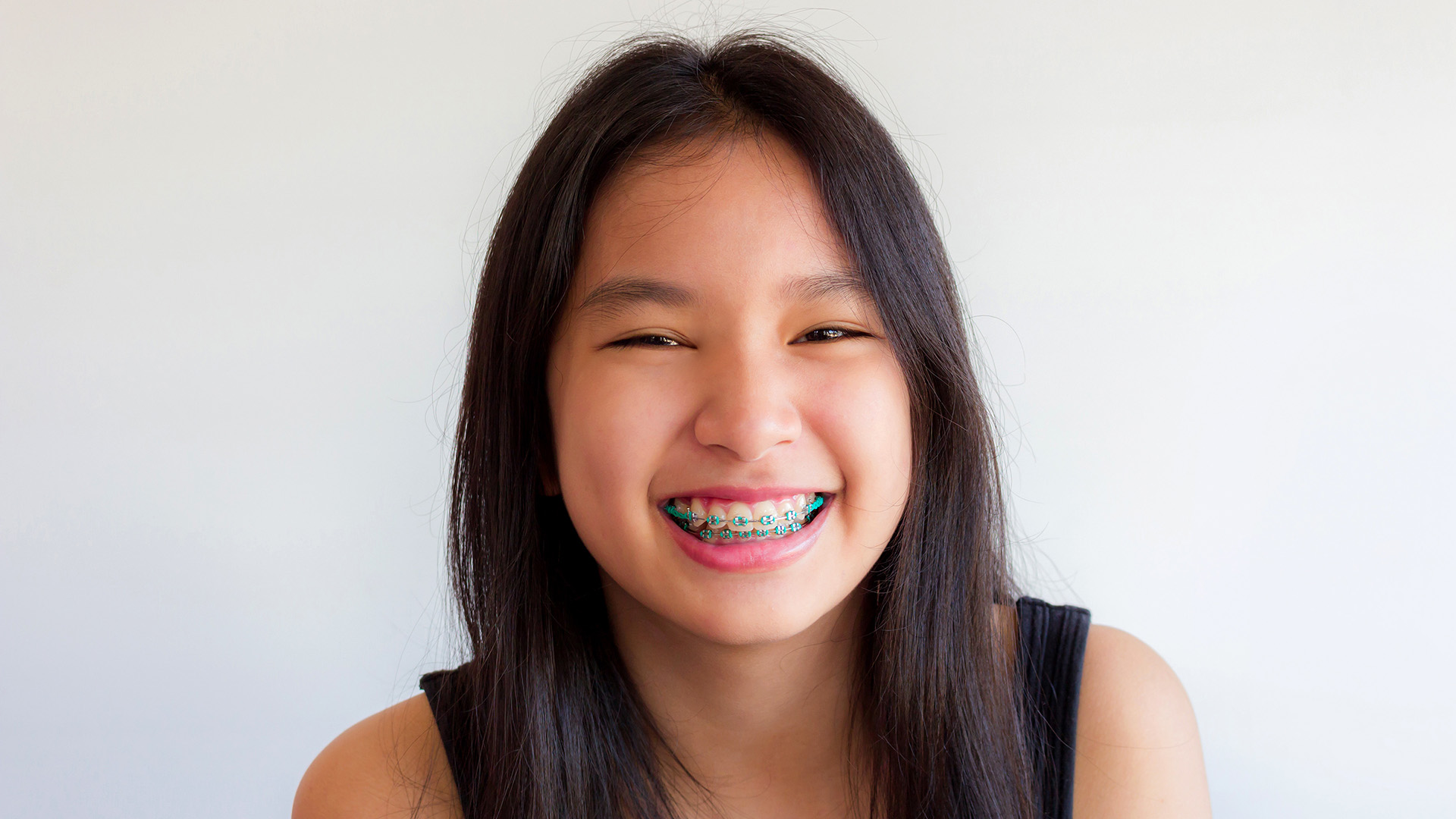 Why Some People Need Braces Twice